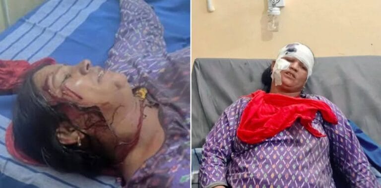 टिहरी प्रतापनगर क्षेत्र में गुलदार हमले के बाद घायल महिला को अस्पताल ले जाते ग्रामीण – वन विभाग की टीम मौके पर