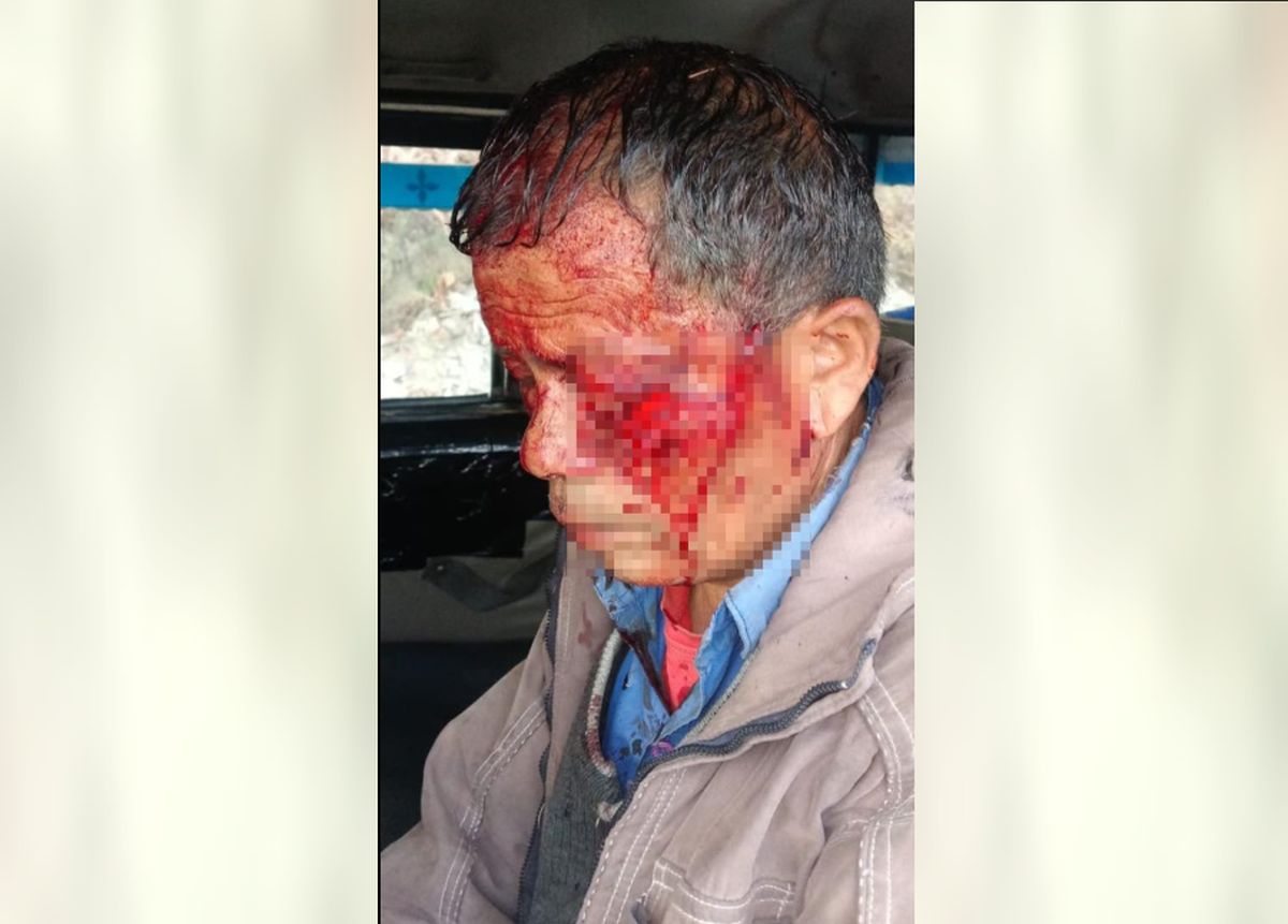 चमोली के सगवाड़ा गांव में भालू का हमला