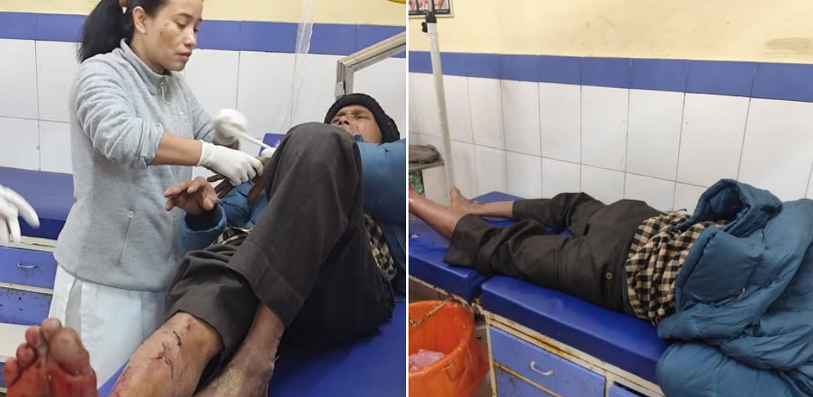 रुद्रप्रयाग में भालू का हमला, वीर भरत सिंह चौधरी गंभीर रूप से घायल; ग्रामीणों ने बचाई जान 1 रुद्रप्रयाग समाचार, भालू हमला, कोट-मल्ला, वन्यजीव संघर्ष, भरत सिंह चौधरी