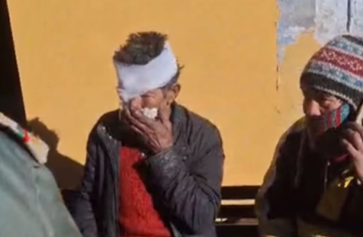 हर्षिल में भालू का हमला, सेब बागान में काम कर रहा व्यक्ति गंभीर रूप से घायल 1 हर्षिल में भालू का हमला