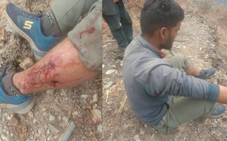 उत्तरकाशी में भालू का हमला | जुणगा गांव में ग्रामीण घायल